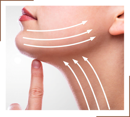 Endoscopic Face Lift