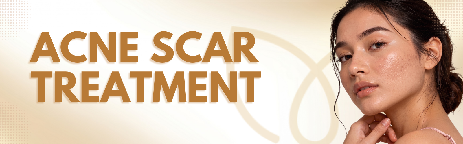 Acne Scar Treatment Delhi Banner - Dr. Monisha Kapoor