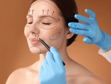 Face Lift Treatment Delhi