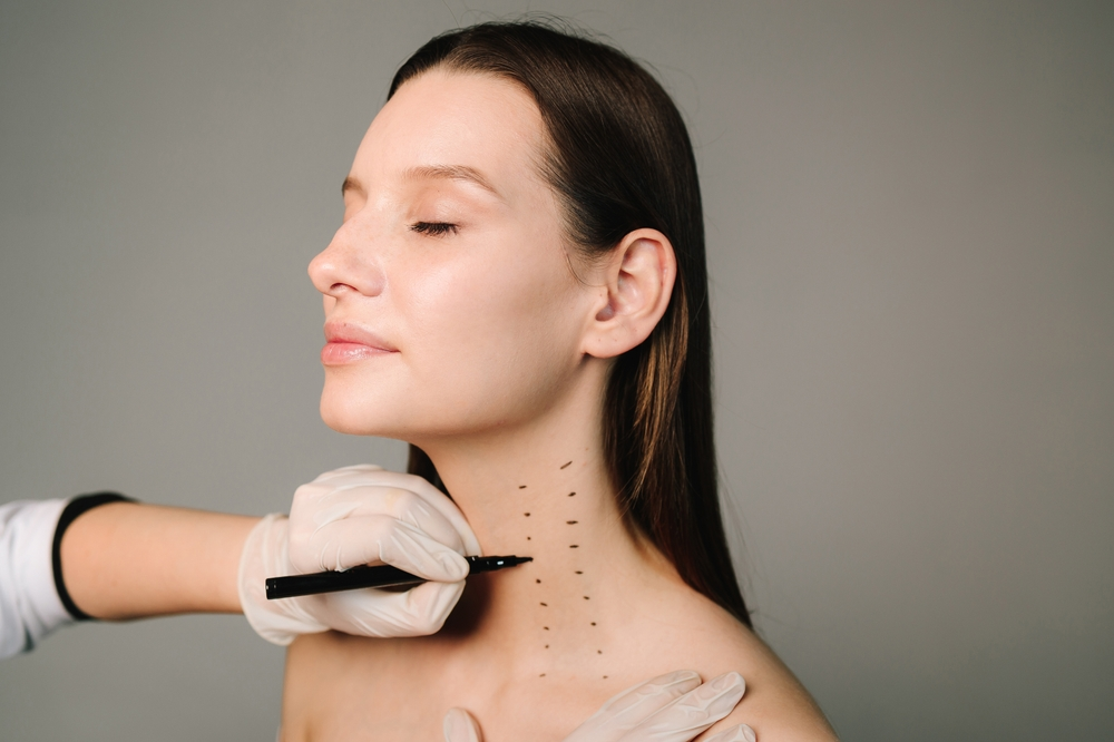 Face and Neck Lift