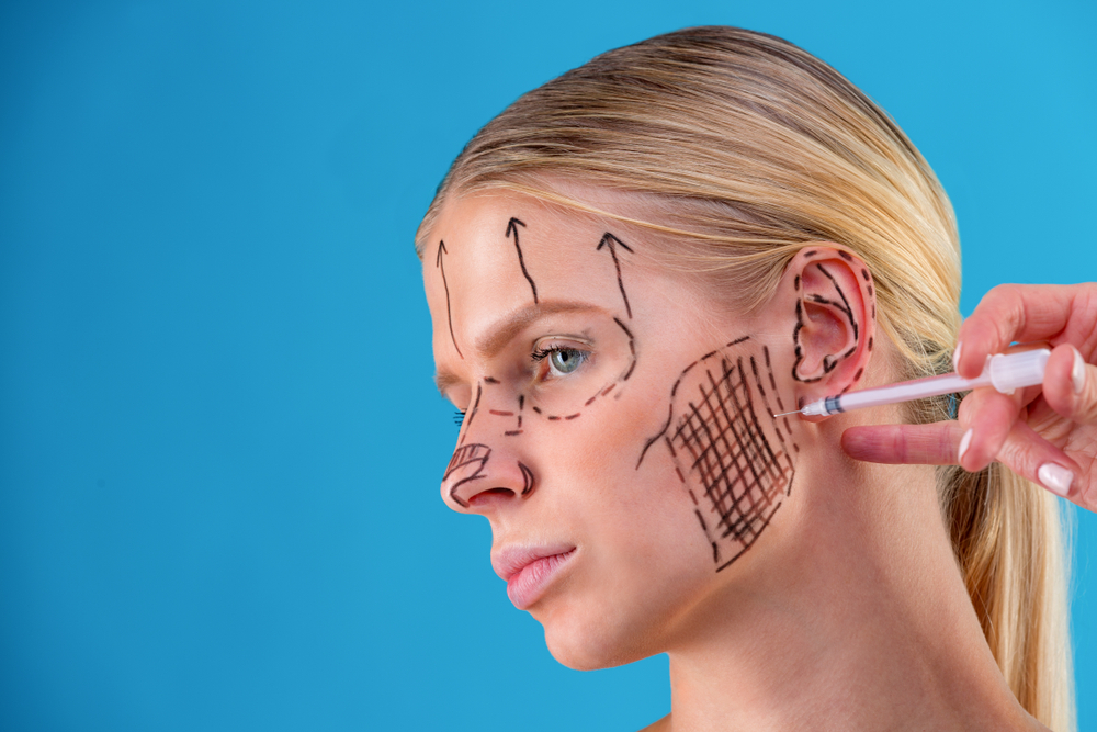 Full Face Lift