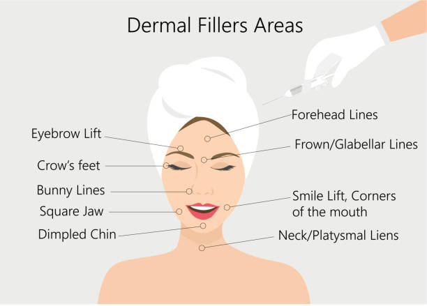 Dermal Filler Areas