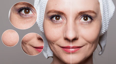 Benefits of Neurotoxin and Filler Treatment