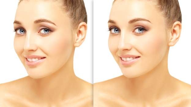 What is Brow Lift Surgery