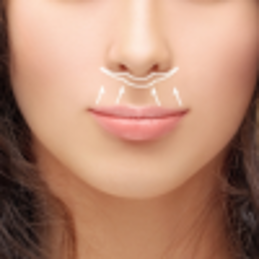 Lip Lift