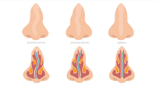Common Nose Concerns We Treat
