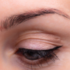 Endoscopic Brow Lift