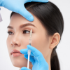 Coronal Brow Lift