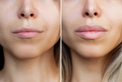 Common Lip Concerns We Treat
