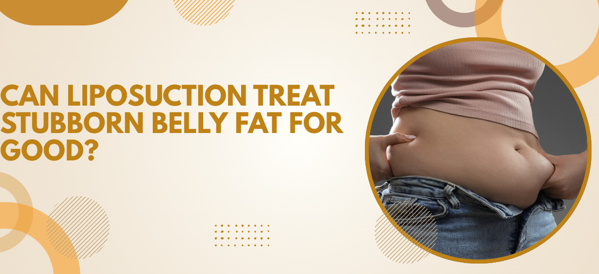 Liposuction for Stubborn Belly Fat