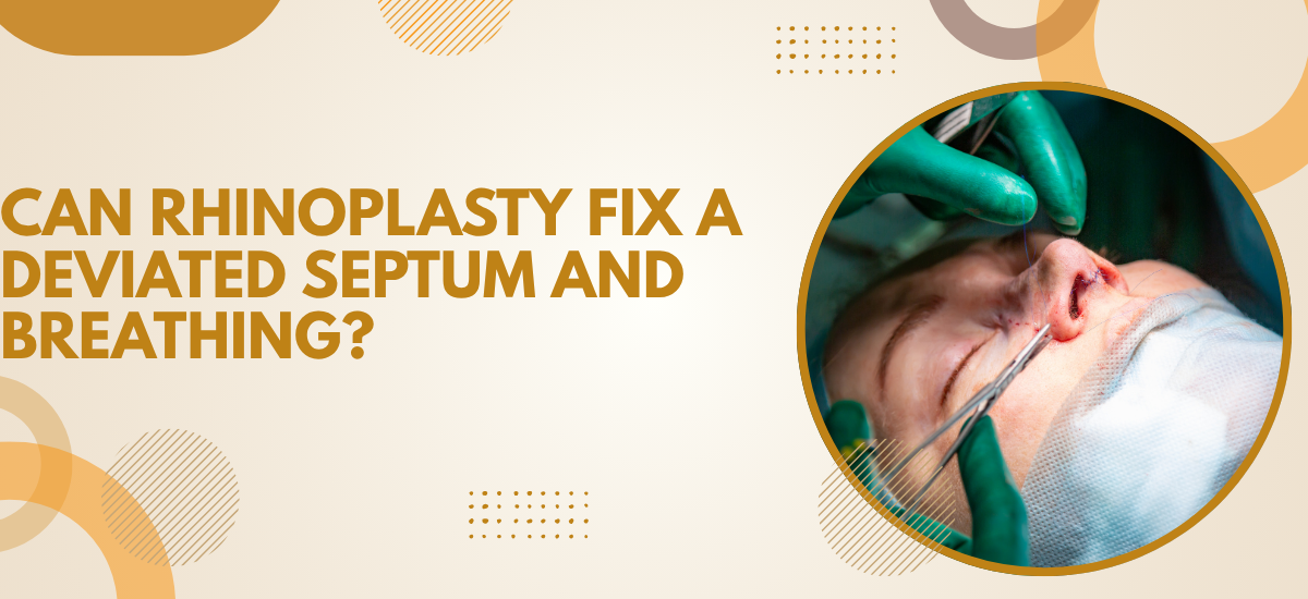 Rhinoplasty Fix a Deviated Septum and Breathing