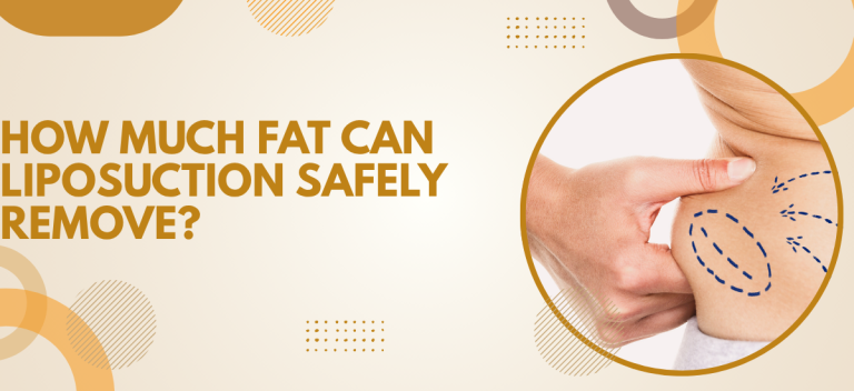 How Much Fat Can Liposuction Safely Remove?