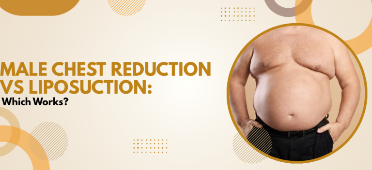 Male Chest Reduction vs Liposuction: Which Works?