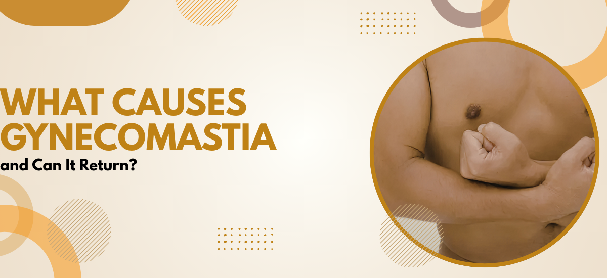 Causes of Gynecomastia