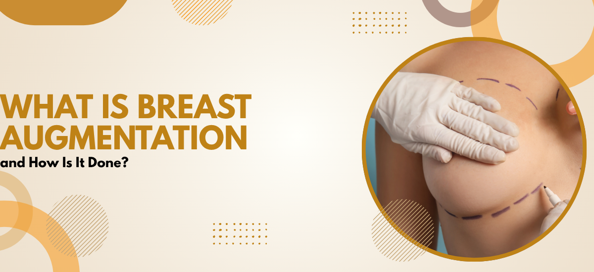 Breast Augmentation