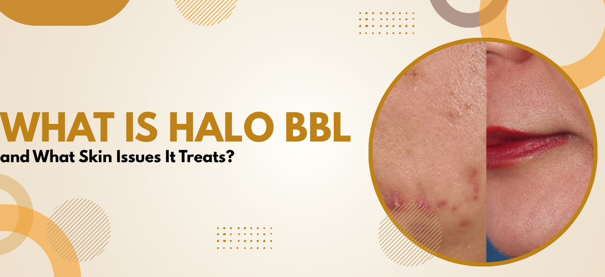 Halo BBL laser skin treatment