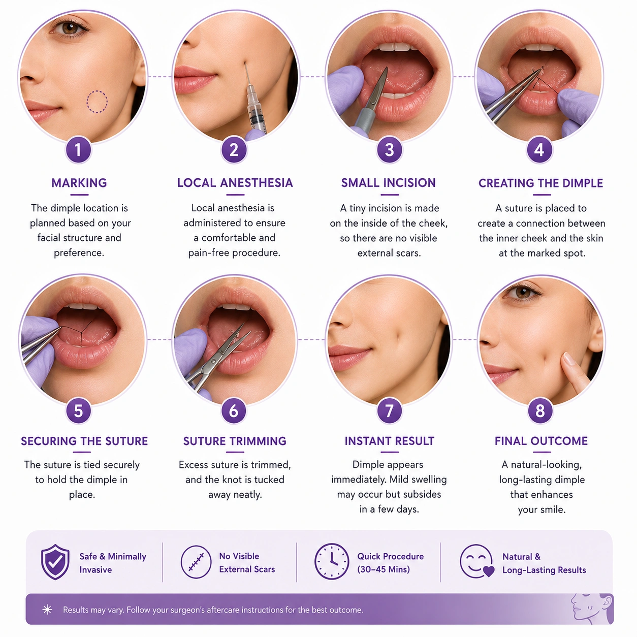 How Dimple Creation Surgery Is Performed Step-by-Step