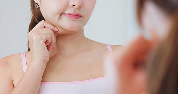 Am I a Good Candidate for Double Chin Removal?