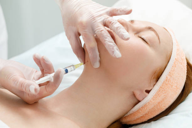 Kybella Injections