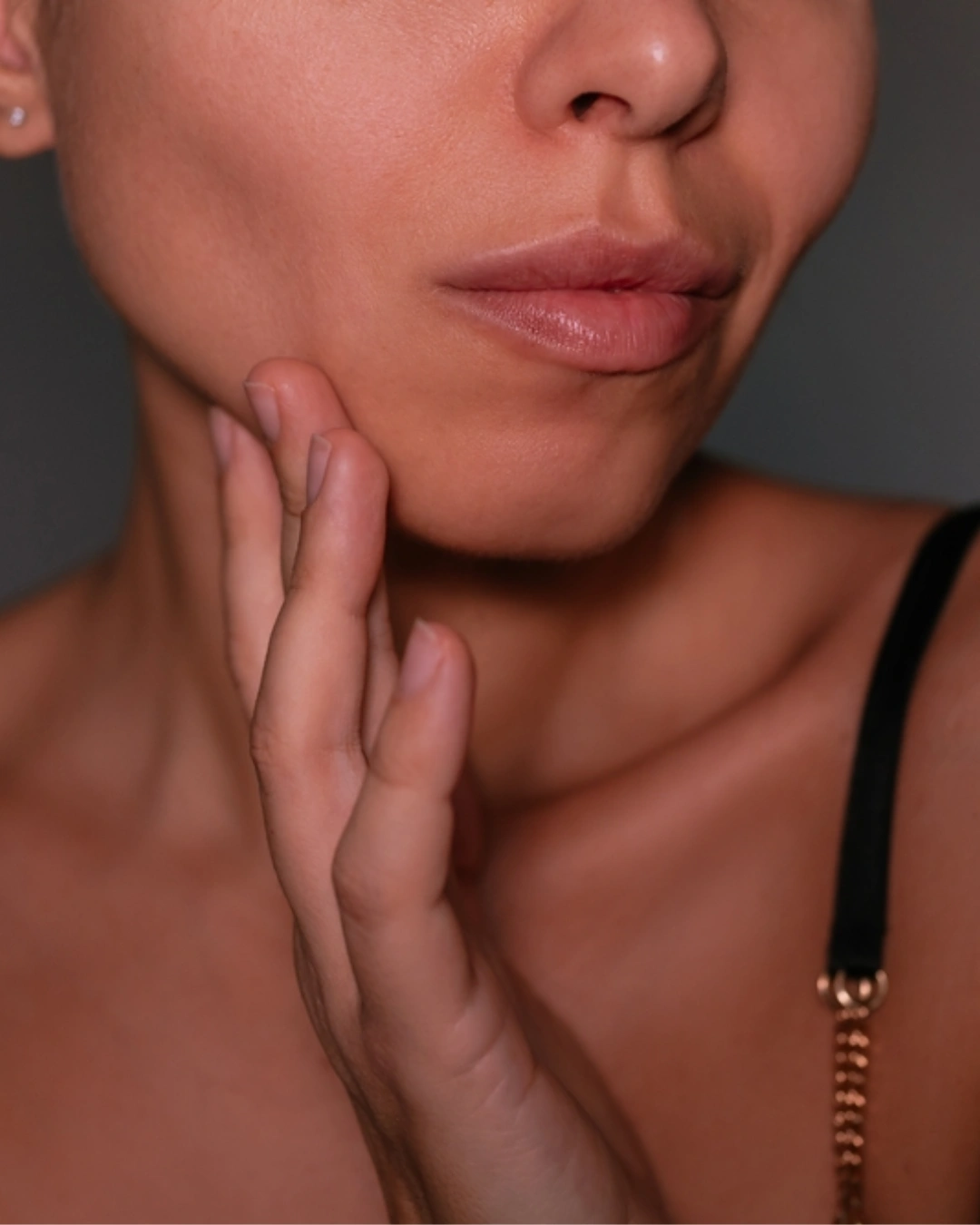 Buccal Fat Removal