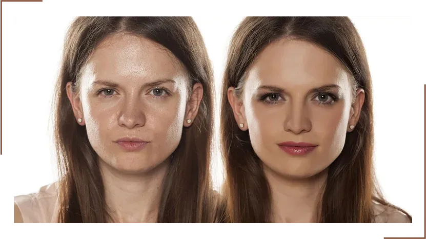 Benefits of Face Bone Change Treatment