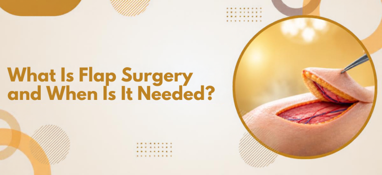 What Is Flap Surgery and When Is It Needed?
