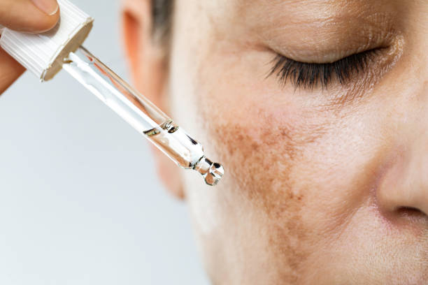 Sun-Damage Protocol