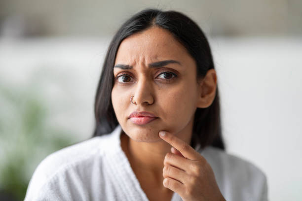 Skin Concerns Treated With Silk Peel Treatment