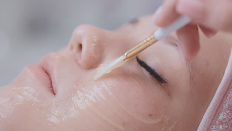 What to Expect During a Chemical Peel Treatment?