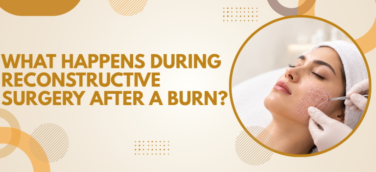 What Happens During Reconstructive Surgery After a Burn?