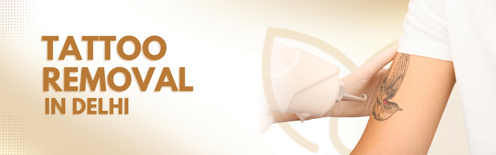 Tattoo Removal in Delhi