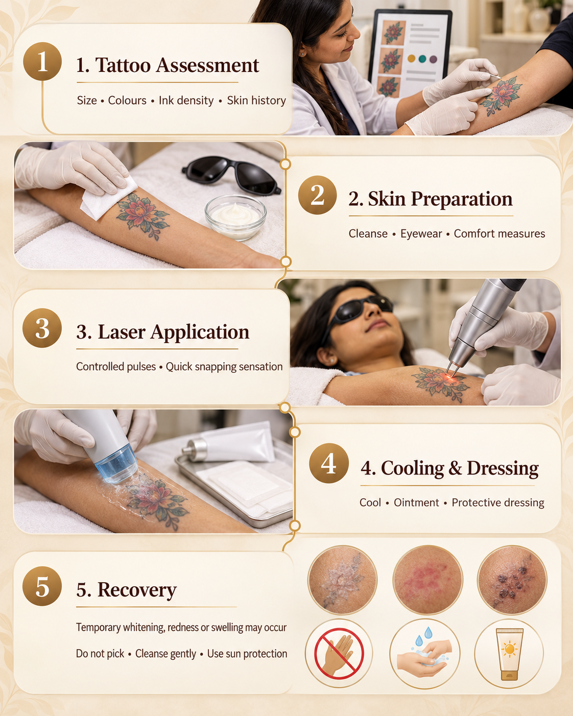 What to Expect During Tattoo Removal